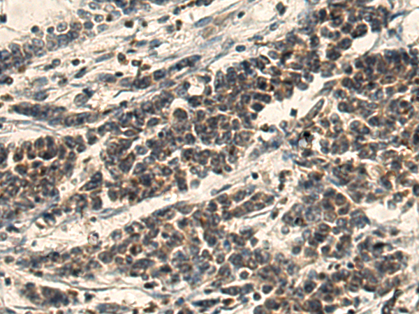 Rabbit Polyclonal Antibody to AKT1S1