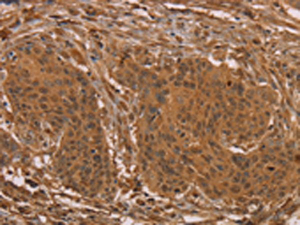 Rabbit Polyclonal Antibody to PRC1