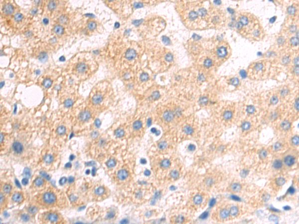 Rabbit Polyclonal Antibody to PRM1