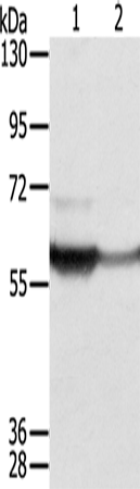 Rabbit Polyclonal Antibody to CTSA