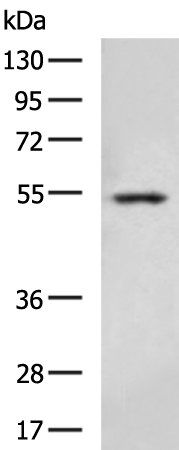Rabbit Polyclonal Antibody to TMPRSS2
