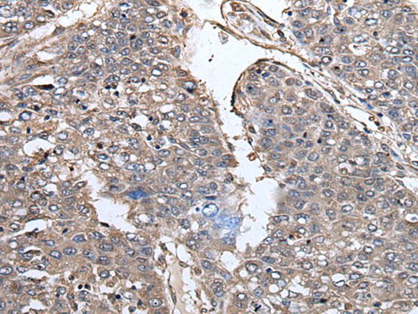 Rabbit Polyclonal Antibody to PRUNE1
