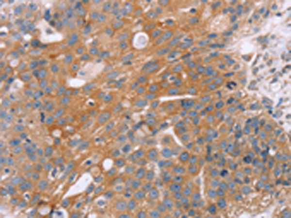 Rabbit Polyclonal Antibody to OPTN