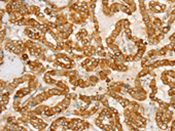 Rabbit Polyclonal Antibody to PTPN22