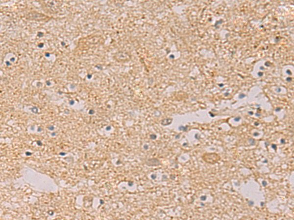 Rabbit Polyclonal Antibody to PTPRN