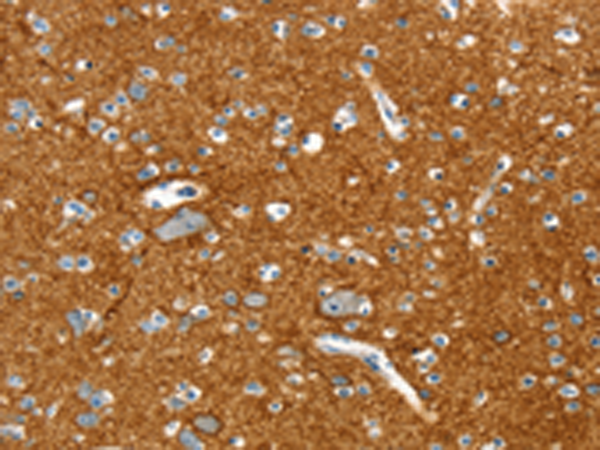 Rabbit Polyclonal Antibody to PTPN3