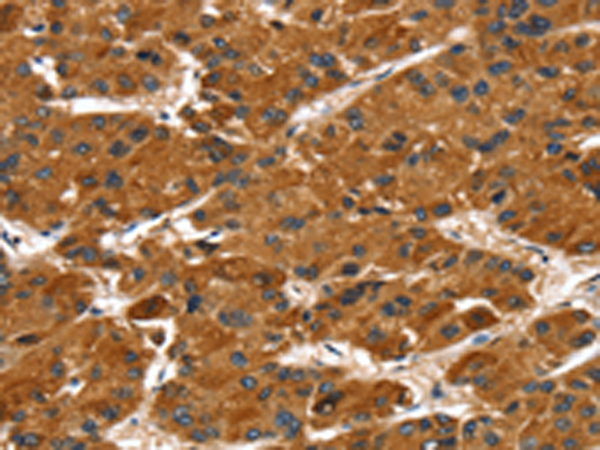 Rabbit Polyclonal Antibody to PTPN5