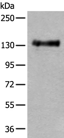 Rabbit Polyclonal Antibody to PTPRA