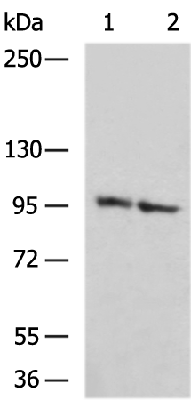 Rabbit Polyclonal Antibody to PYGL