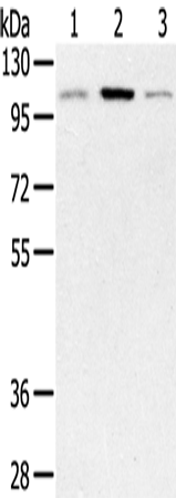 Rabbit Polyclonal Antibody to PYGM
