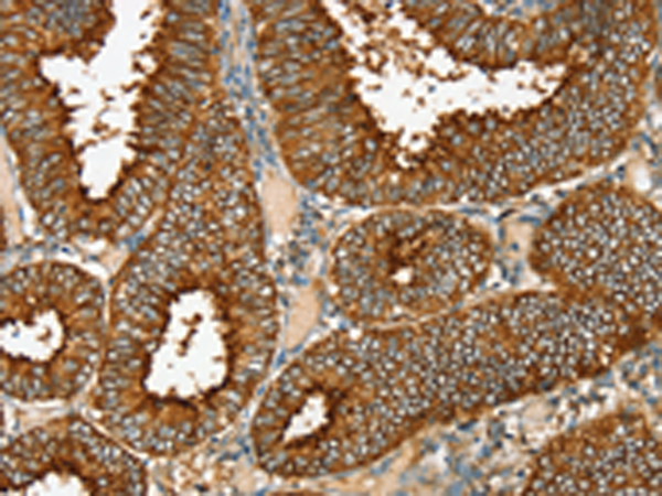 Rabbit Polyclonal Antibody to RAB25