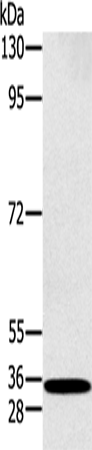 Rabbit Polyclonal Antibody to RAB27A