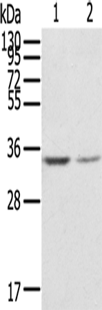 Rabbit Polyclonal Antibody to RACK1