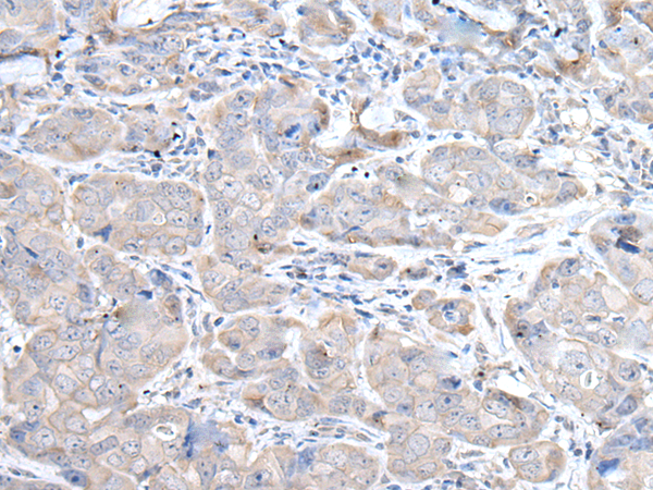 Rabbit Polyclonal Antibody to RASA1