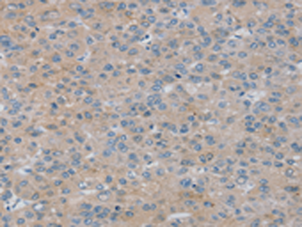 Rabbit Polyclonal Antibody to RASA4