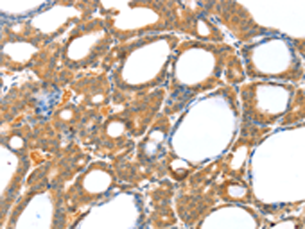 Rabbit Polyclonal Antibody to RASAL1