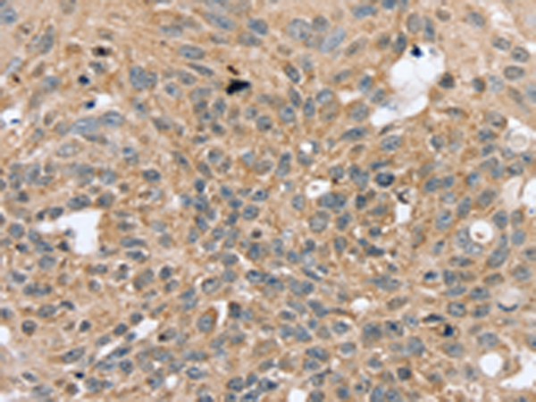 Rabbit Polyclonal Antibody to RASGEF1A