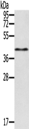 Rabbit Polyclonal Antibody to RASSF4