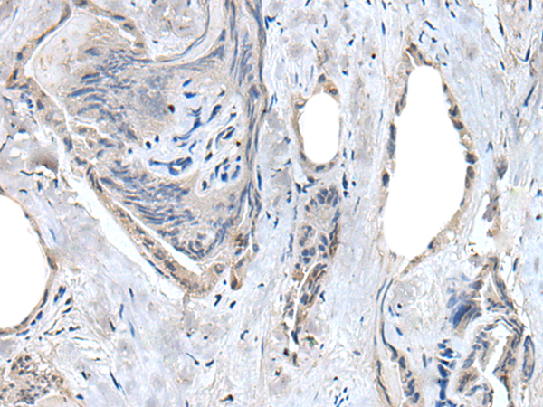 Rabbit Polyclonal Antibody to RASSF8