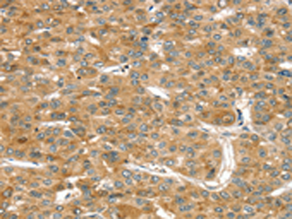 Rabbit Polyclonal Antibody to RASSF9