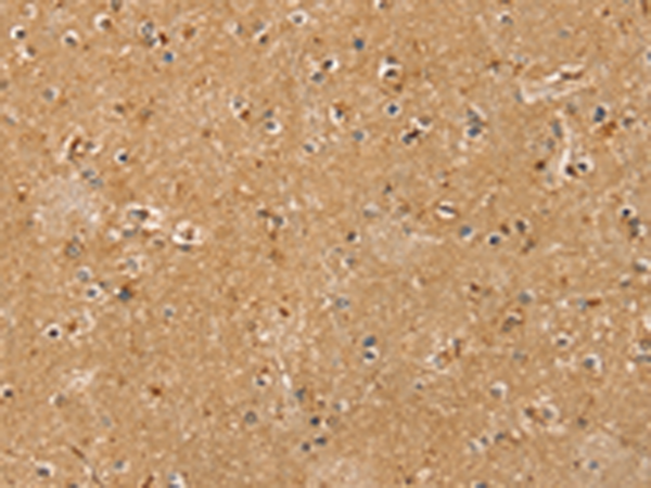 Rabbit Polyclonal Antibody to RASSF1