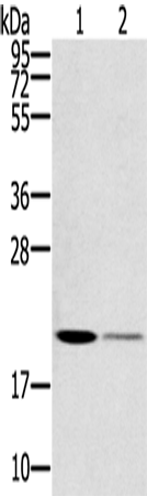 Rabbit Polyclonal Antibody to RBBP9
