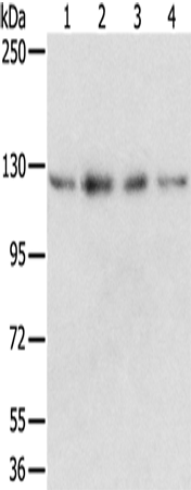 Rabbit Polyclonal Antibody to RBM5