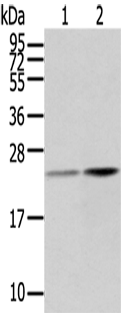 Rabbit Polyclonal Antibody to RBP4
