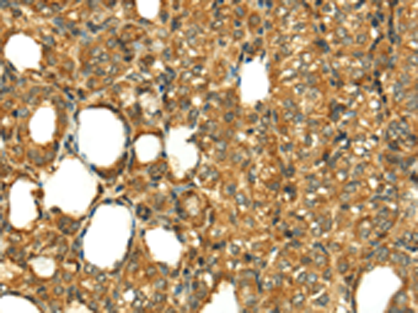 Rabbit Polyclonal Antibody to RLN1