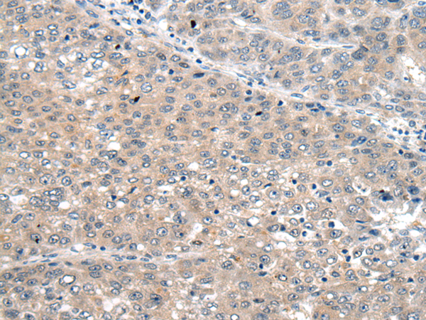 Rabbit Polyclonal Antibody to SEMA4D