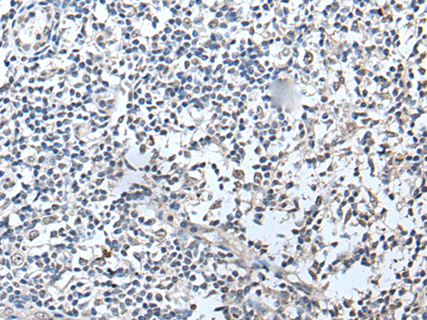 Rabbit Polyclonal Antibody to RERG