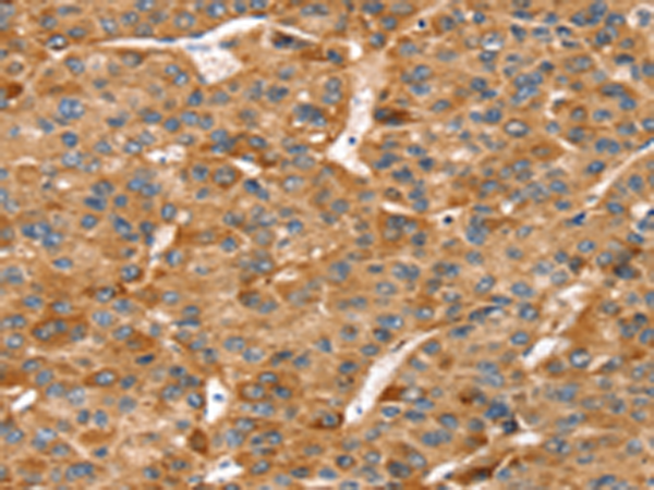 Rabbit Polyclonal Antibody to RFFL