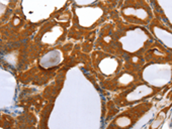 Rabbit Polyclonal Antibody to RGS5