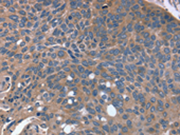 Rabbit Polyclonal Antibody to RGS4