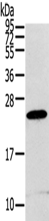 Rabbit Polyclonal Antibody to RGS1