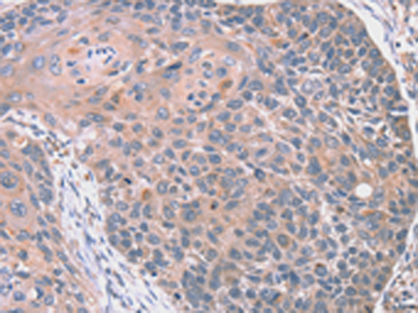 Rabbit Polyclonal Antibody to RGS10