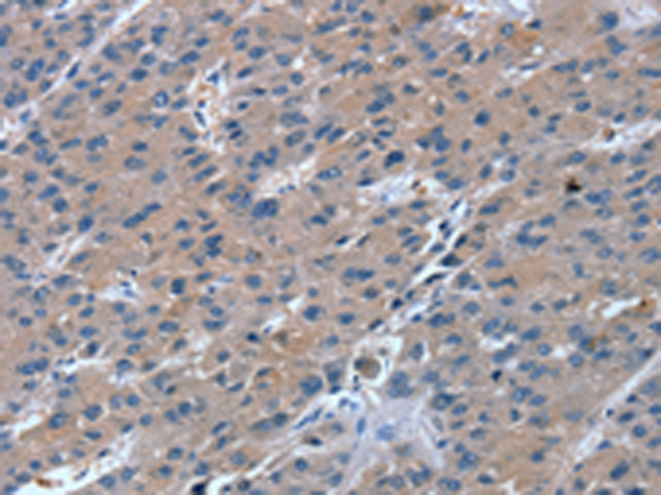 Rabbit Polyclonal Antibody to RGS11