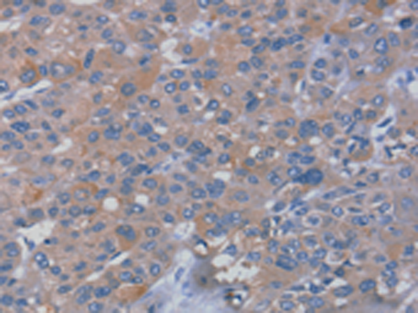 Rabbit Polyclonal Antibody to RHEB
