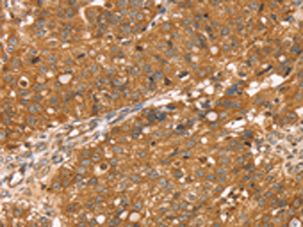 Rabbit Polyclonal Antibody to RNASET2