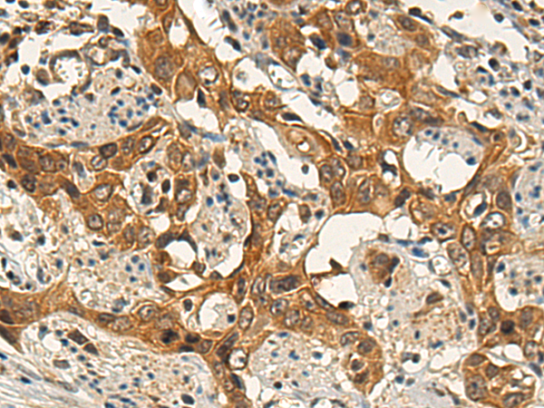 Rabbit Polyclonal Antibody to RIPK2