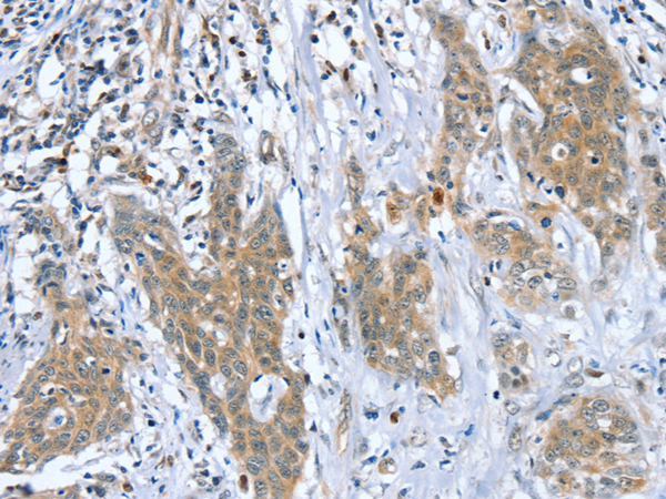 Rabbit Polyclonal Antibody to DSTYK