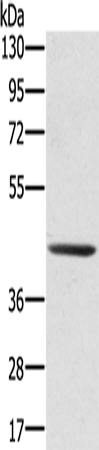 Rabbit Polyclonal Antibody to SCPEP1