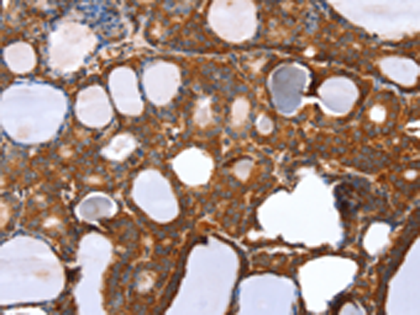 Rabbit Polyclonal Antibody to RNF11