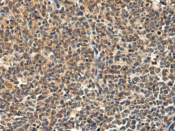 Rabbit Polyclonal Antibody to RNF128