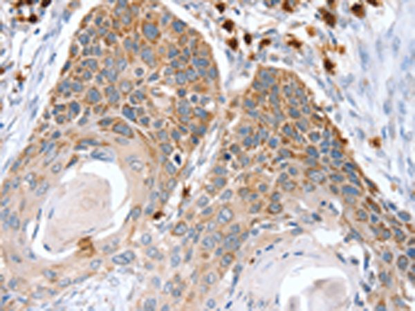Rabbit Polyclonal Antibody to RNF185