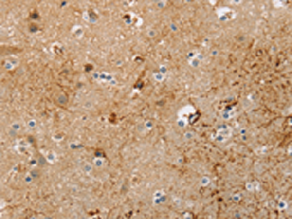 Rabbit Polyclonal Antibody to TRIM69