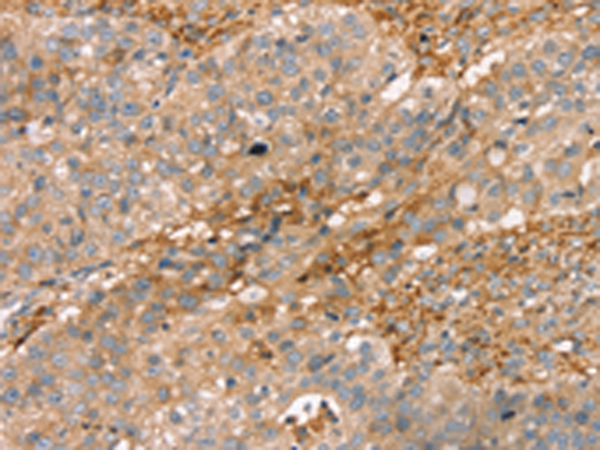 Rabbit Polyclonal Antibody to ROBO3