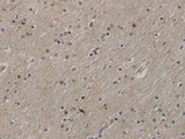 Rabbit Polyclonal Antibody to ROBO4