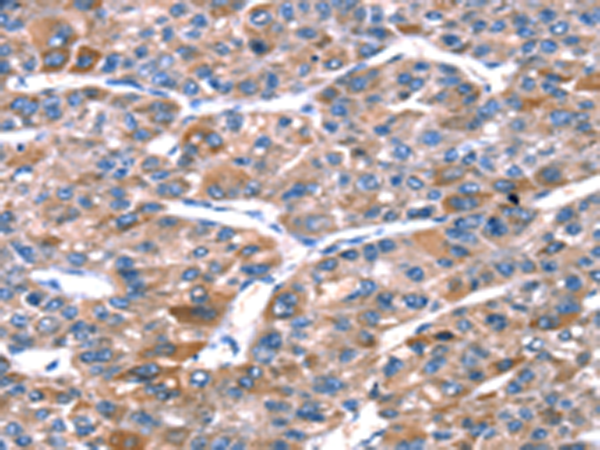 Rabbit Polyclonal Antibody to RPL11