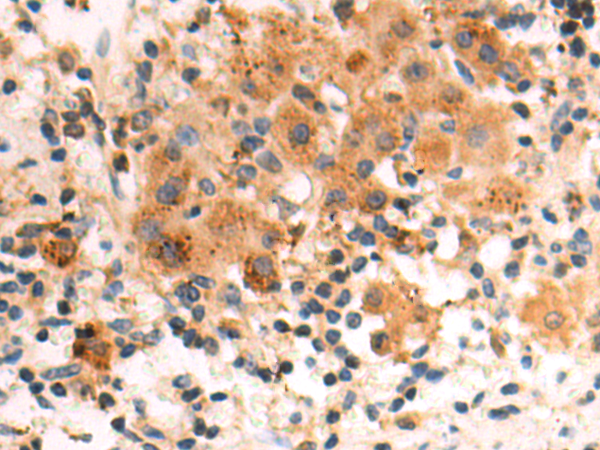 Rabbit Polyclonal Antibody to RPL15